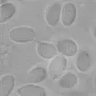Spore image mushroom spore image
